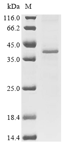 (Tris-Glycine gel) Discontinuous SDS-PAGE (reduced) with 5% enrichment gel and 15% separation gel. Boiling SDS-treated samples may result in membrane protein aggregation. Incubation at 37 centigrade for 10 min is an effective alternative.